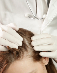 quali trattamenti sono indicati in caso di perdita di capelli?