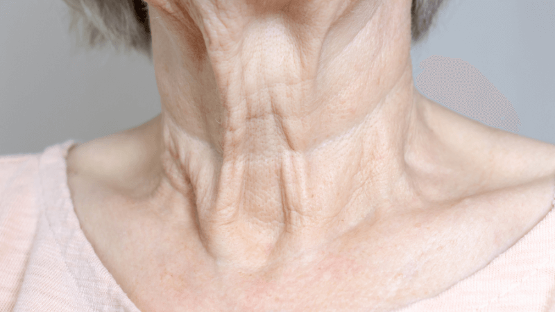 Pelle del collo cadente: conoscere cause e rimedi