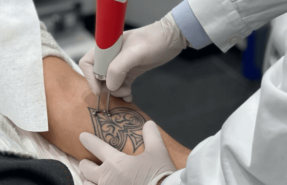tatuaggio sicuro dermatologo milano dermoclinico